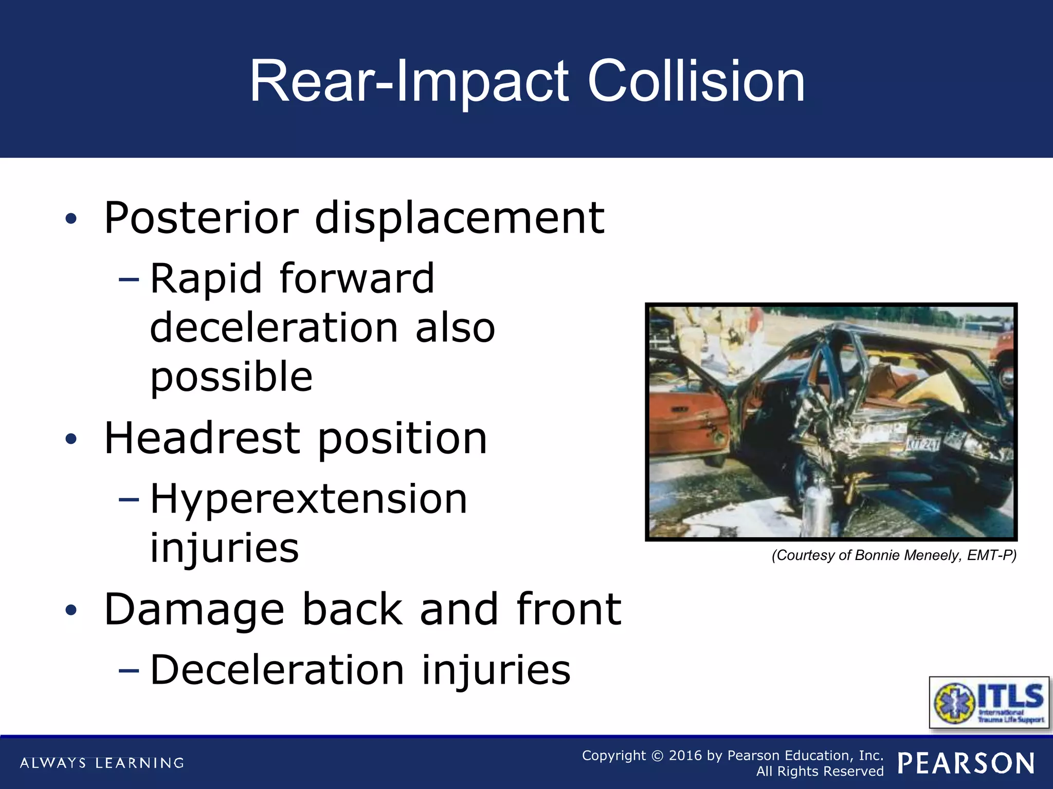 Copyright © 2016 by Pearson Education, Inc.
All Rights Reserved
Rear-Impact Collision
• Posterior displacement
– Rapid forward
deceleration also
possible
• Headrest position
– Hyperextension
injuries
• Damage back and front
– Deceleration injuries
(Courtesy of Bonnie Meneely, EMT-P)
 