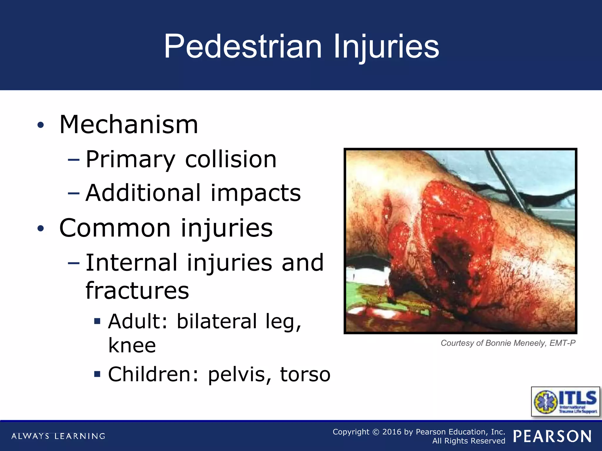 Copyright © 2016 by Pearson Education, Inc.
All Rights Reserved
Pedestrian Injuries
• Mechanism
– Primary collision
– Additional impacts
• Common injuries
– Internal injuries and
fractures
 Adult: bilateral leg,
knee
 Children: pelvis, torso
Courtesy of Bonnie Meneely, EMT-P
 