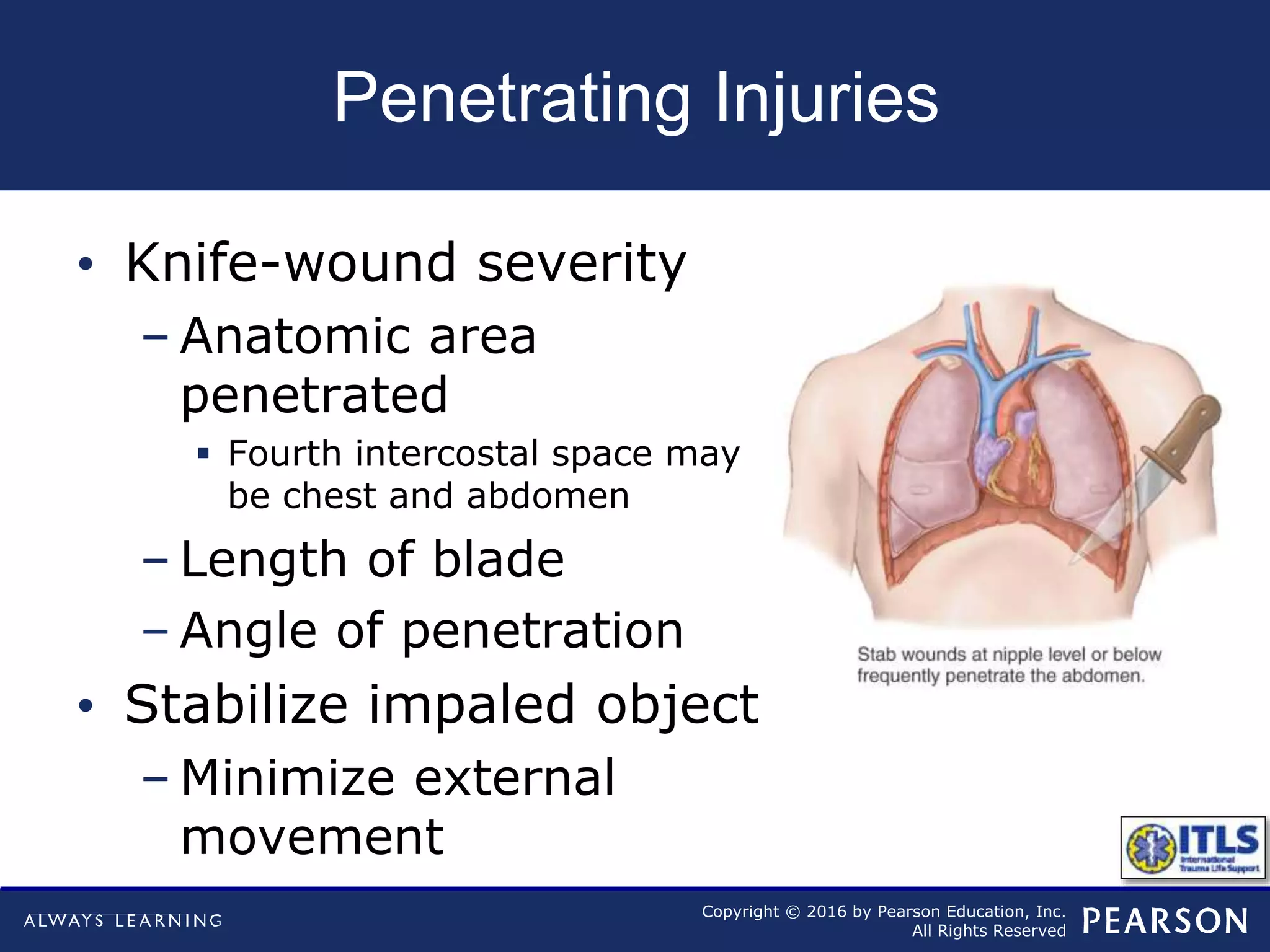 Copyright © 2016 by Pearson Education, Inc.
All Rights Reserved
Penetrating Injuries
• Knife-wound severity
– Anatomic area
penetrated
 Fourth intercostal space may
be chest and abdomen
– Length of blade
– Angle of penetration
• Stabilize impaled object
– Minimize external
movement
 