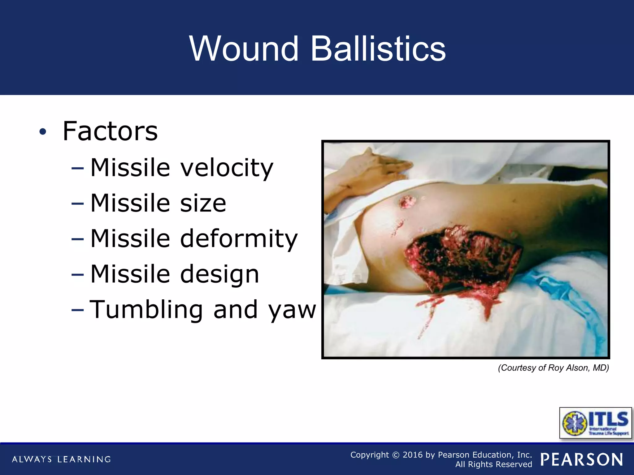 Copyright © 2016 by Pearson Education, Inc.
All Rights Reserved
Wound Ballistics
• Factors
– Missile velocity
– Missile size
– Missile deformity
– Missile design
– Tumbling and yaw
(Courtesy of Roy Alson, MD)
 