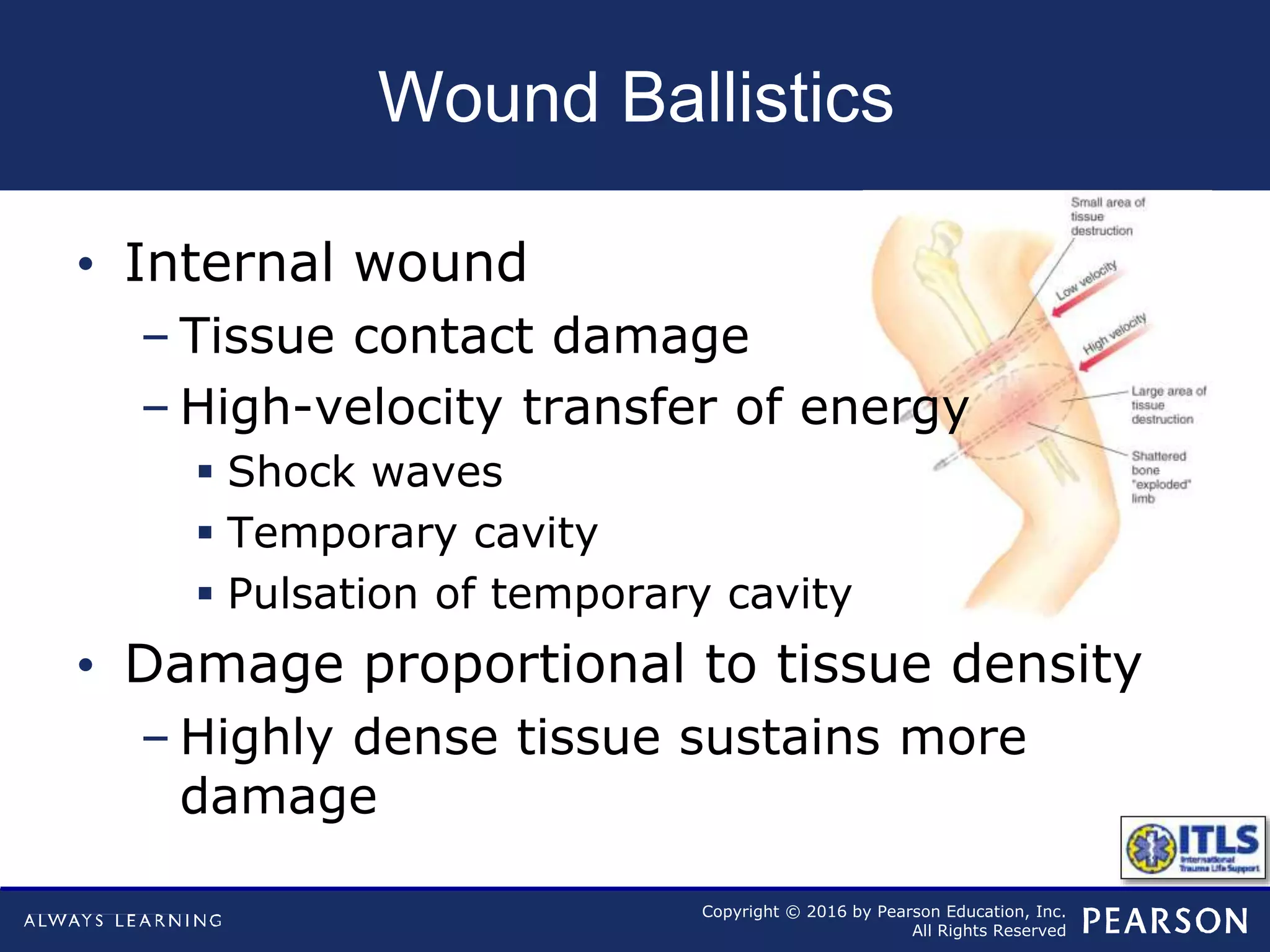 Copyright © 2016 by Pearson Education, Inc.
All Rights Reserved
Wound Ballistics
• Internal wound
– Tissue contact damage
– High-velocity transfer of energy
 Shock waves
 Temporary cavity
 Pulsation of temporary cavity
• Damage proportional to tissue density
– Highly dense tissue sustains more
damage
 