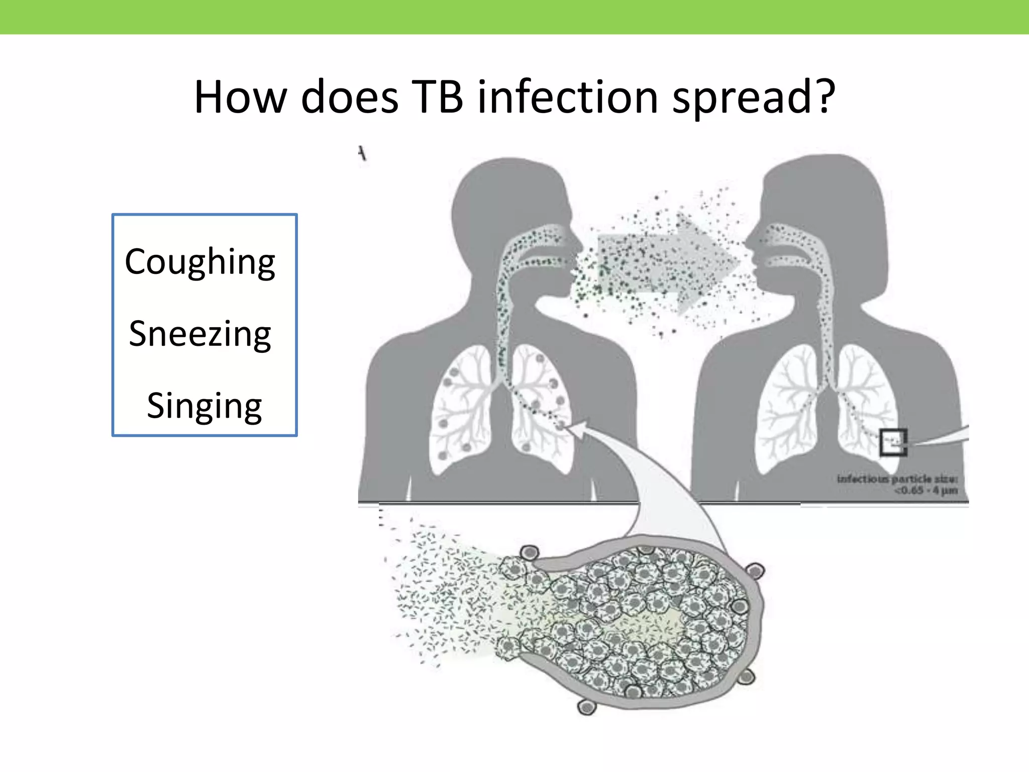 Chapter 1 understanding tb | PPT