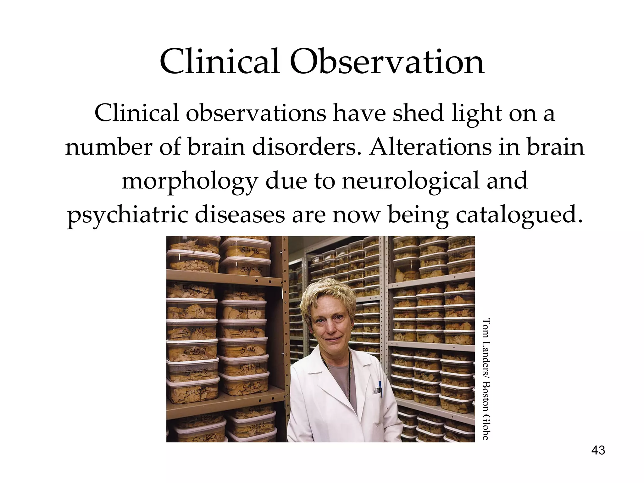 Clinical Observation Clinical observations have shed light on a number of brain disorders. Alterations in brain morphology due to neurological and psychiatric diseases are now being catalogued. Tom Landers/ Boston Globe 