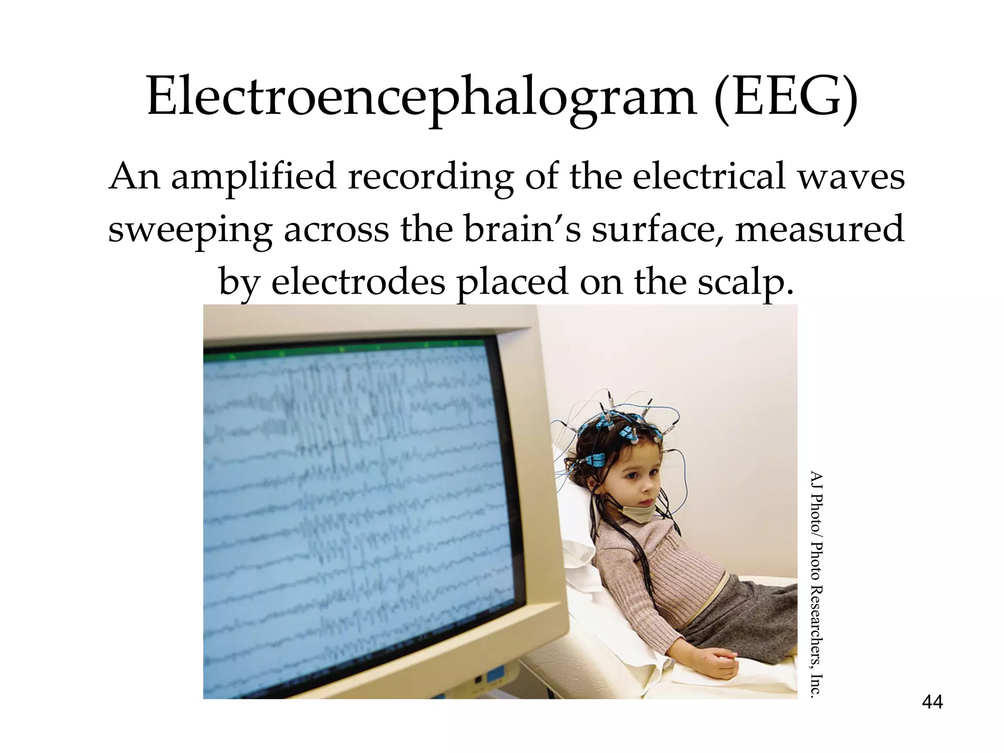 Electroencephalogram (EEG) An amplified recording of the electrical waves sweeping across the brain’s surface, measured by electrodes placed on the scalp. AJ Photo/ Photo Researchers, Inc. 