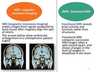 27
MRI (magnetic resonance imaging)
makes images from signals produced by
brain tissue after magnets align the spin
of atoms.
The arrows below show ventricular
enlargement in a schizophrenic patient
(right).
MRI: magnetic
resonance imaging
Functional MRI reveals
brain activity and
function rather than
structures.
Functional MRI
compares successive
MRI images taken a
split second apart, and
shows changes in the
level of oxygen in
bloodflow in the brain.
fMRI: functional MRI
 