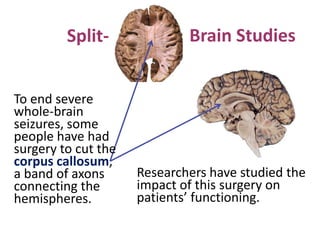 Brain Studies
Researchers have studied the
impact of this surgery on
patients’ functioning.
Split-
To end severe
whole-brain
seizures, some
people have had
surgery to cut the
corpus callosum,
a band of axons
connecting the
hemispheres.
 