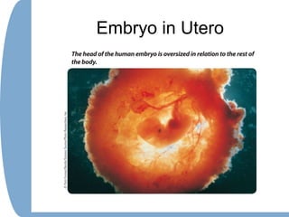 Embryo in Utero
 