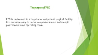 The purpose of PEG
PEG is performed in a hospital or outpatient surgical facility.
It is not necessary to perform a percutaneous endoscopic
gastronomy in an operating room.
 