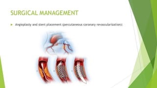 Congestive Heart Failure