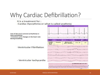 Why Cardiac Defibrillation?
02/03/2026 MEDICAL INSTRUMENTATION 15
 