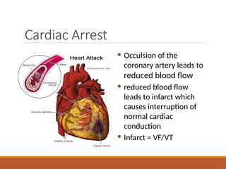 Cardiac Arrest
 Occulsion of the
coronary artery leads to
reduced blood flow
 reduced blood flow
leads to infarct which
causes interruption of
normal cardiac
conduction
 Infarct = VF/VT
 