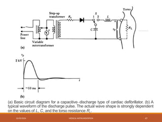 02/03/2026 MEDICAL INSTRUMENTATION 47
(a) Basic circuit diagram for a capacitive–discharge type of cardiac defibrillator. (b) A
typical waveform of the discharge pulse. The actual wave shape is strongly dependent
on the values of L, C, and the torso resistance RL.
 