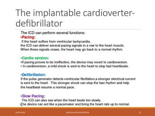 The implantable cardioverter-
defibrillator
02/03/2026 MEDICAL INSTRUMENTATION 72
 