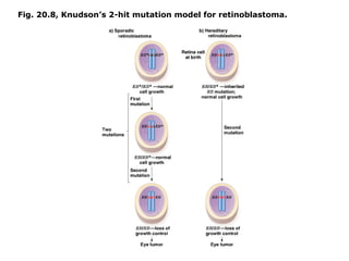 Fig. 20.8, Knudson’s 2-hit mutation model for retinoblastoma.
 