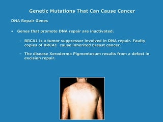 Genetic Mutations That Can Cause CancerGenetic Mutations That Can Cause Cancer
DNA Repair GenesDNA Repair Genes
• Genes that promote DNA repair are inactivated.Genes that promote DNA repair are inactivated.
– BRCA1 is a tumor suppressor involved in DNA repair. FaultyBRCA1 is a tumor suppressor involved in DNA repair. Faulty
copies of BRCA1 cause inherited breast cancer.copies of BRCA1 cause inherited breast cancer.
– The disease Xeroderma Pigmentosum results from a defect inThe disease Xeroderma Pigmentosum results from a defect in
excision repair.excision repair.
 