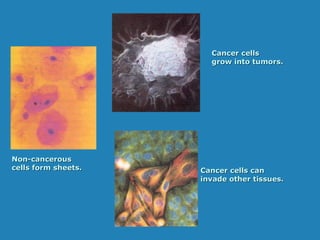 Non-cancerousNon-cancerous
cells form sheets.cells form sheets.
Cancer cellsCancer cells
grow into tumors.grow into tumors.
Cancer cells canCancer cells can
invade other tissues.invade other tissues.
 