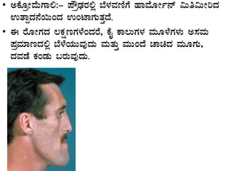 • CPÉÆæÃªÉÄUÁ°:- ¥ËæqsÀgÀ°è ¨É¼ÀªÀtÂUÉ ºÁªÉÆÃð£ï «Äw«ÄÃjzÀ
GvÁàzÀ£É¬ÄAzÀ GAmÁUÀÄvÀÛzÉ.
• F gÉÆÃUÀzÀ ®PÀëtUÀ¼ÉAzÀgÉ, PÉÊ PÁ®ÄUÀ¼À ªÀÄÆ¼ÉUÀ¼ÀÄ C¸ÀªÀÄ
¥ÀæªÀiÁtzÀ°è ¨É¼ÉAiÀÄÄªÀÅzÀÄ ªÀÄvÀÄÛ ªÀÄÄAzÉ ZÁazÀ ªÀÄÆUÀÄ,
zÀªÀqÉ PÀAqÀÄ §gÀÄªÀÅzÀÄ.
 