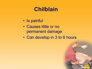 Chilblain
• Is painful
• Causes little or no
permanent damage
• Can develop in 3 to 6 hours
 
