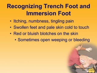 Recognizing Trench Foot and
Immersion Foot
• Itching, numbness, tingling pain
• Swollen feet and pale skin cold to touch
• Red or bluish blotches on the skin
• Sometimes open weeping or bleeding
 
