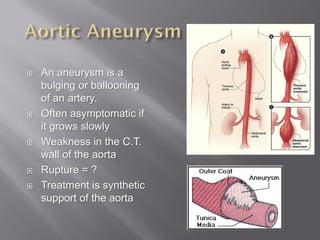    An aneurysm is a
    bulging or ballooning
    of an artery.
   Often asymptomatic if
    it grows slowly
   Weakness in the C.T.
    wall of the aorta
   Rupture = ?
   Treatment is synthetic
    support of the aorta
 