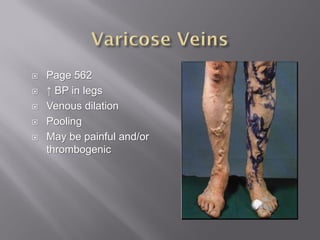    Page 562
   ↑ BP in legs
   Venous dilation
   Pooling
   May be painful and/or
    thrombogenic
 