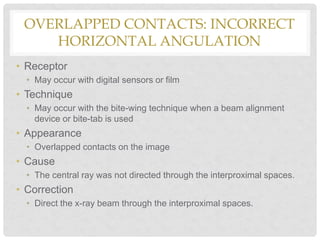 Chapter 20: Exposure and Technique Errors | PPT