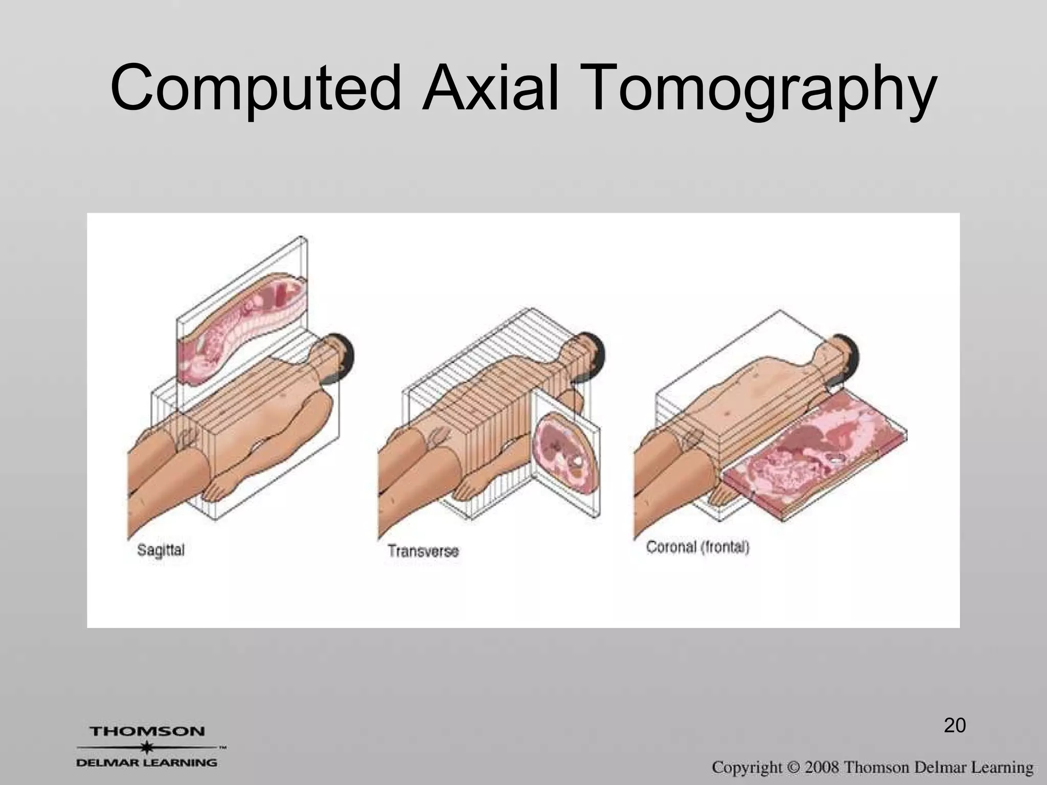 Computed Axial Tomography 