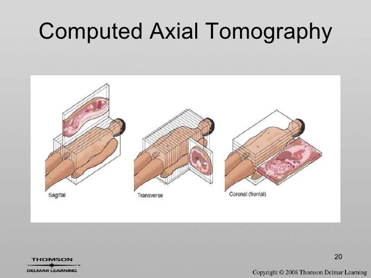 Chapter20 radiology and diagnostic imaging terminology