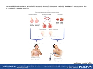 Prehospital Emergency Care, 10th
edition
Mistovich | Karren
Copyright © 2014, 2010, 2008 by Pearson Education, Inc.
All Rights Reserved
Life-threatening responses in anaphylactic reaction: bronchoconstriction, capillary permeability, vasodilation, and
an increase in mucus production.
continued on next slide
 