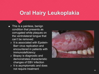 60
Oral Hairy Leukoplakia
 This is a painless, benign
condition that presents as
corrugated white plaques on
the ventrolateral tongue that
can’t be removed
 It is associated with Epstein-
Barr virus replication and
encountered in patients with
immunodeficiency
 Biopsy is diagnostic and
demonstrates characteristic
changes of EBV infection
 It is asymptomatic and does
not require treatment
 