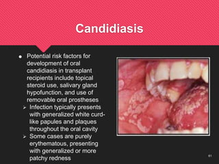 61
Candidiasis
 Potential risk factors for
development of oral
candidiasis in transplant
recipients include topical
steroid use, salivary gland
hypofunction, and use of
removable oral prostheses
 Infection typically presents
with generalized white curd-
like papules and plaques
throughout the oral cavity
 Some cases are purely
erythematous, presenting
with generalized or more
patchy redness
 
