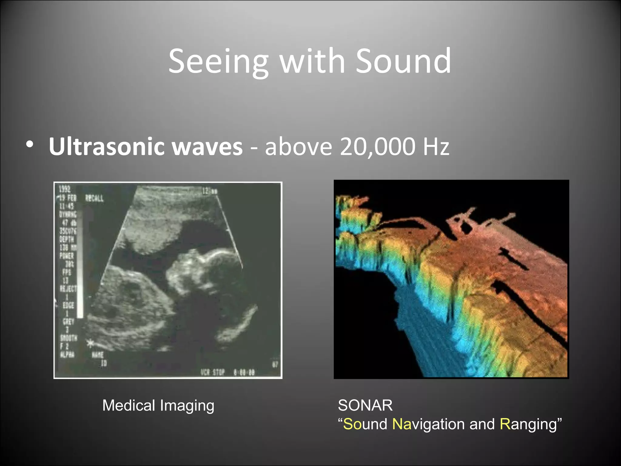 Seeing with Sound
• Ultrasonic waves - above 20,000 Hz
Medical Imaging SONAR
“Sound Navigation and Ranging”
 