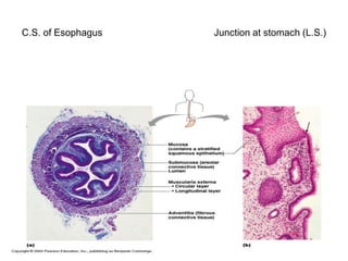 C.S. of Esophagus Junction at stomach (L.S.)
 