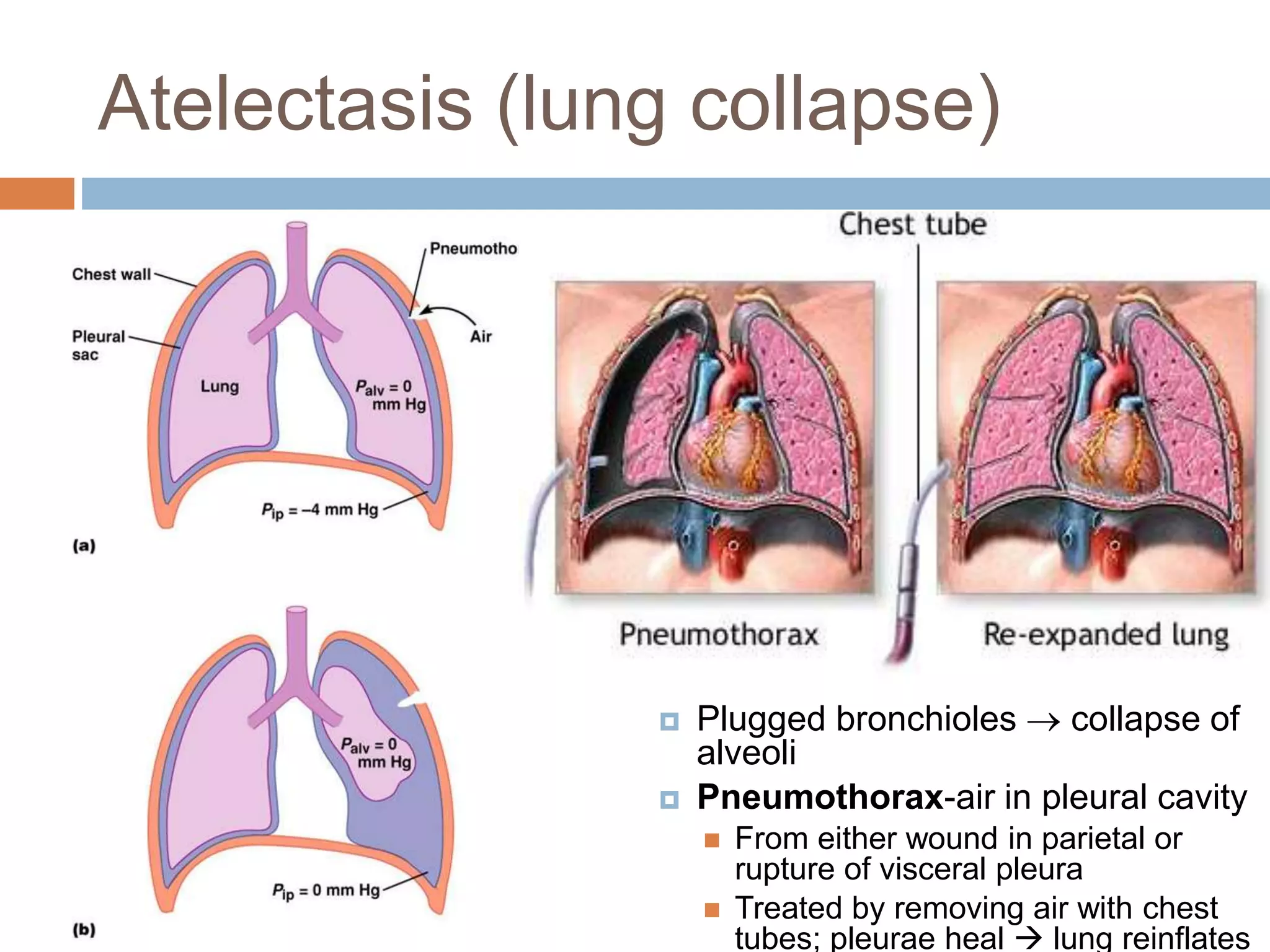 Atelectasis (lung collapse)
 Plugged bronchioles  collapse of
alveoli
 Pneumothorax-air in pleural cavity
 From either wound in parietal or
rupture of visceral pleura
 Treated by removing air with chest
tubes; pleurae heal  lung reinflates
 