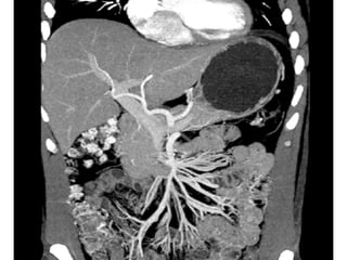 Chapter23 digestivepart2marieb