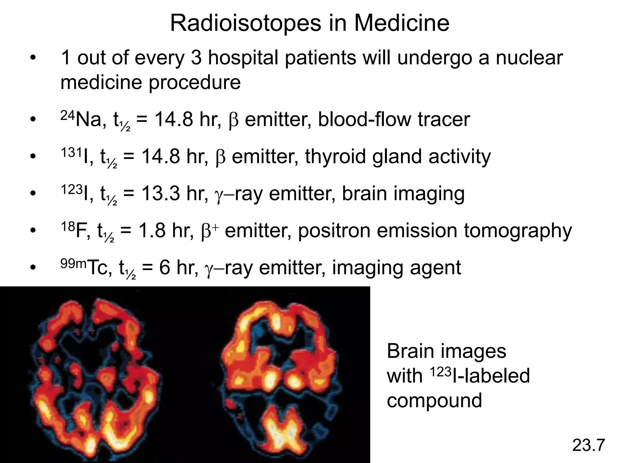 23.7
Radioisotopes in Medicine
• 1 out of every 3 hospital patients will undergo a nuclear
medicine procedure
• 24Na, t½ = 14.8 hr, b emitter, blood-flow tracer
• 131I, t½ = 14.8 hr, b emitter, thyroid gland activity
• 123I, t½ = 13.3 hr, g-ray emitter, brain imaging
• 18F, t½ = 1.8 hr, b+ emitter, positron emission tomography
• 99mTc, t½ = 6 hr, g-ray emitter, imaging agent
Brain images
with 123I-labeled
compound
 
