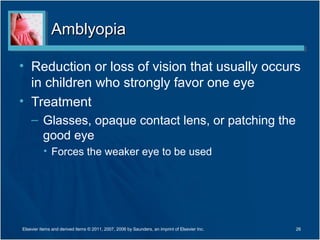 AmblyopiaAmblyopia
• Reduction or loss of vision that usually occurs
in children who strongly favor one eye
• Treatment
– Glasses, opaque contact lens, or patching the
good eye
• Forces the weaker eye to be used
Elsevier items and derived items © 2011, 2007, 2006 by Saunders, an imprint of Elsevier Inc. 26
 
