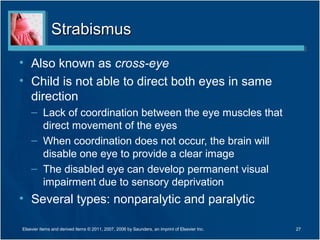 StrabismusStrabismus
• Also known as cross-eye
• Child is not able to direct both eyes in same
direction
– Lack of coordination between the eye muscles that
direct movement of the eyes
– When coordination does not occur, the brain will
disable one eye to provide a clear image
– The disabled eye can develop permanent visual
impairment due to sensory deprivation
• Several types: nonparalytic and paralytic
27Elsevier items and derived items © 2011, 2007, 2006 by Saunders, an imprint of Elsevier Inc.
 