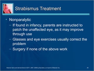 Strabismus TreatmentStrabismus Treatment
• Nonparalytic
– If found in infancy, parents are instructed to
patch the unaffected eye, as it may improve
through use
– Glasses and eye exercises usually correct the
problem
– Surgery if none of the above work
29Elsevier items and derived items © 2011, 2007, 2006 by Saunders, an imprint of Elsevier Inc.
 
