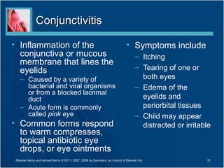 ConjunctivitisConjunctivitis
• Inflammation of the
conjunctiva or mucous
membrane that lines the
eyelids
– Caused by a variety of
bacterial and viral organisms
or from a blocked lacrimal
duct
– Acute form is commonly
called pink eye
• Common forms respond
to warm compresses,
topical antibiotic eye
drops, or eye ointments
• Symptoms include
– Itching
– Tearing of one or
both eyes
– Edema of the
eyelids and
periorbital tissues
– Child may appear
distracted or irritable
31Elsevier items and derived items © 2011, 2007, 2006 by Saunders, an imprint of Elsevier Inc.
 