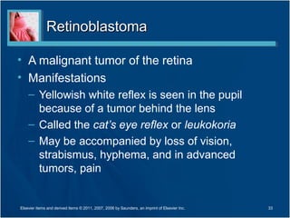 RetinoblastomaRetinoblastoma
• A malignant tumor of the retina
• Manifestations
– Yellowish white reflex is seen in the pupil
because of a tumor behind the lens
– Called the cat’s eye reflex or leukokoria
– May be accompanied by loss of vision,
strabismus, hyphema, and in advanced
tumors, pain
33Elsevier items and derived items © 2011, 2007, 2006 by Saunders, an imprint of Elsevier Inc.
 