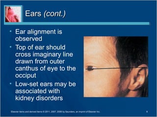 EarsEars (cont.)(cont.)
• Ear alignment is
observed
• Top of ear should
cross imaginary line
drawn from outer
canthus of eye to the
occiput
• Low-set ears may be
associated with
kidney disorders
8Elsevier items and derived items © 2011, 2007, 2006 by Saunders, an imprint of Elsevier Inc.
 