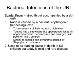 Bacterial Infections of the URT Scarlet Fever  = strep throat accompanied by a skin rash Rash is caused by a bacterial erythrogenic (reddening) toxin Toxin causes a pinkish red rash, high fever Tongue has a strawberry like appearance, loses its upper membrane, becomes red and enlarged, skin peels off like a sunburn Similar to scalded skin syndrome caused by Staphylococcus aureus 2. Used to be leading cause of death in US children but today is mild and rare disease 