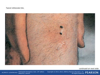 Prehospital Emergency Care, 10th
edition
Mistovich | Karren
Copyright © 2014, 2010, 2008 by Pearson Education, Inc.
All Rights Reserved
Typical rattlesnake bite.
continued on next slide
 