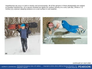 Prehospital Emergency Care, 10th
edition
Mistovich | Karren
Copyright © 2014, 2010, 2008 by Pearson Education, Inc.
All Rights Reserved
Hypothermia can occur in cold or merely cool environments. All of the persons in these photographs are subject
to possible hypothermia: (a) a person dressed too lightly for outdoor activity on a very cold day, (Photo a: ©
Corbis) (b) a person sleeping outdoors on a cool surface in cool weather.
continued on next slide
 