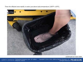 Prehospital Emergency Care, 10th
edition
Mistovich | Karren
Copyright © 2014, 2010, 2008 by Pearson Education, Inc.
All Rights Reserved
Thaw the affected area rapidly in water just above body temperature (100°F–110°F).
continued on next slide
 