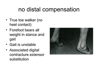 chapter 24 Ankle Equinus.ppt on ankle equinus pod | PPT