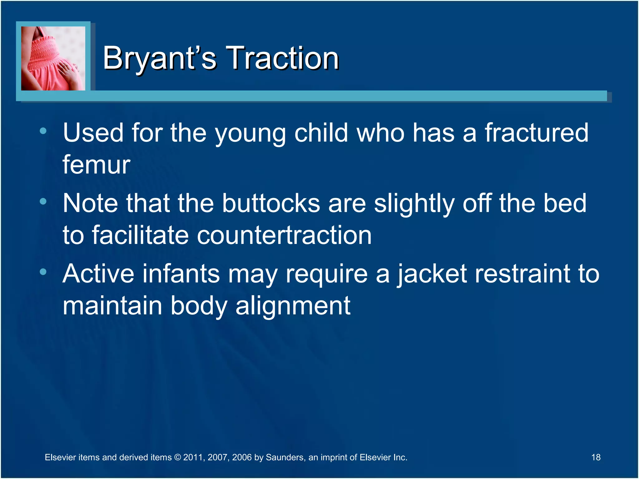 Bryant’s TractionBryant’s Traction
• Used for the young child who has a fractured
femur
• Note that the buttocks are slightly off the bed
to facilitate countertraction
• Active infants may require a jacket restraint to
maintain body alignment
18Elsevier items and derived items © 2011, 2007, 2006 by Saunders, an imprint of Elsevier Inc.
 