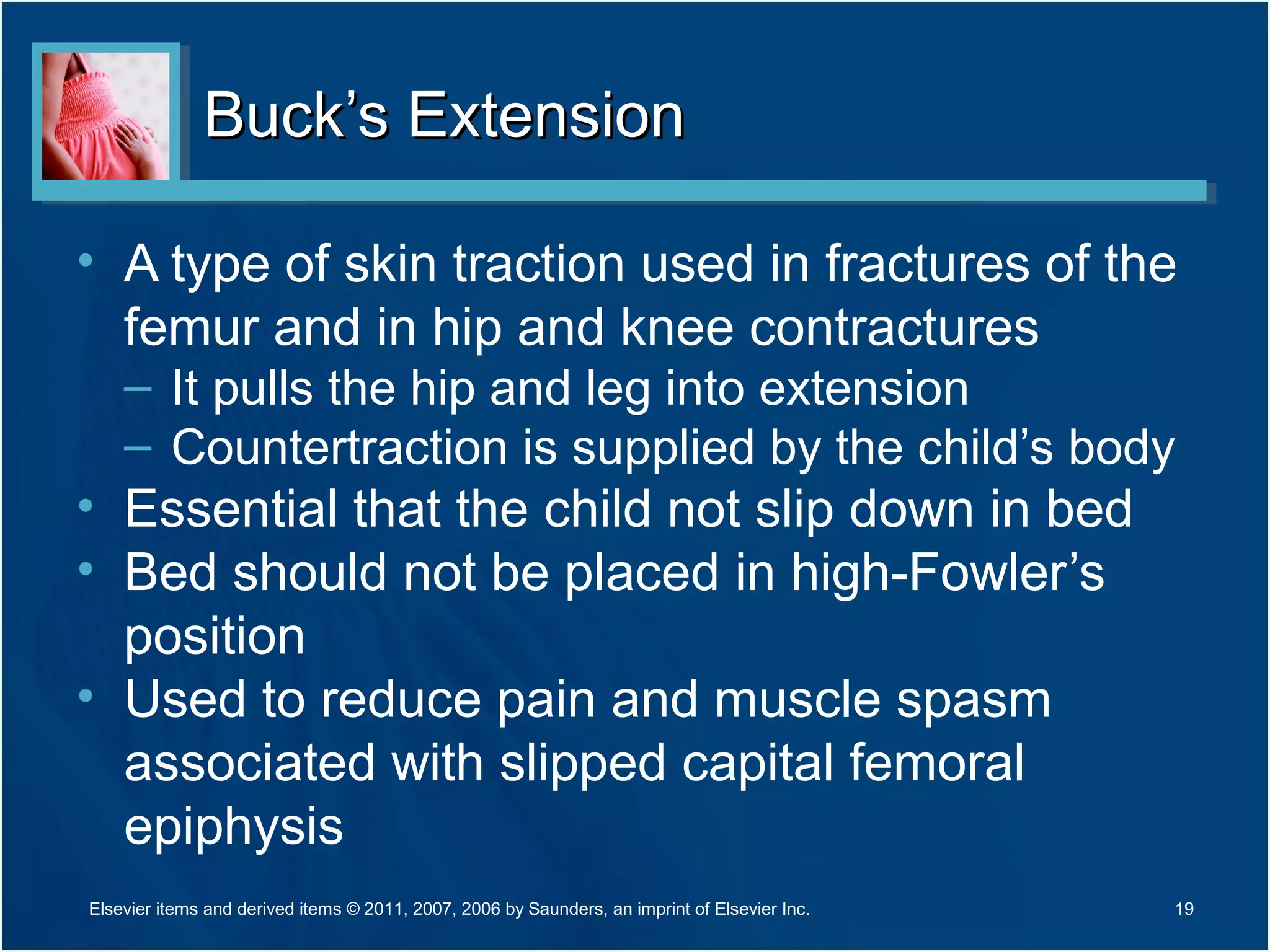 Buck’s ExtensionBuck’s Extension
• A type of skin traction used in fractures of the
femur and in hip and knee contractures
– It pulls the hip and leg into extension
– Countertraction is supplied by the child’s body
• Essential that the child not slip down in bed
• Bed should not be placed in high-Fowler’s
position
• Used to reduce pain and muscle spasm
associated with slipped capital femoral
epiphysis
Elsevier items and derived items © 2011, 2007, 2006 by Saunders, an imprint of Elsevier Inc. 19
 