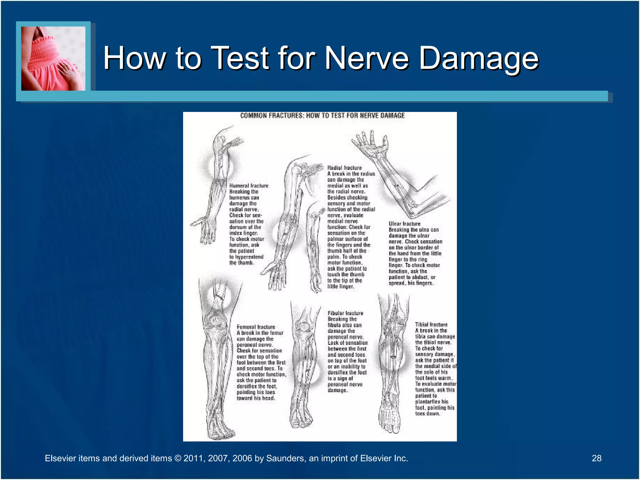 How to Test for Nerve DamageHow to Test for Nerve Damage
28Elsevier items and derived items © 2011, 2007, 2006 by Saunders, an imprint of Elsevier Inc.
 